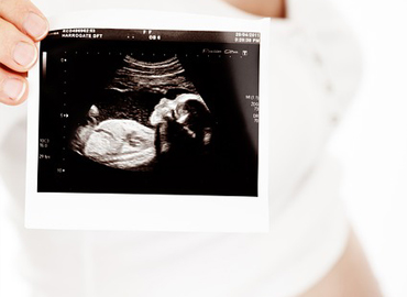 Amniocentesis