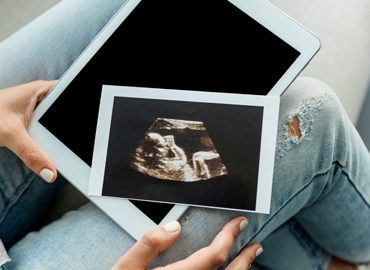 ¿Que ecografias realizarse durante el embarazo?